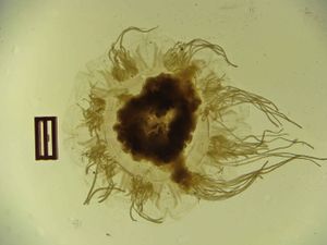 Cyanea sp-11.jpg