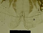 Pic. 17. Close-up of Rhopalium (Bottom Illum/ Full trans).)