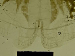 Cyanea sp-17.jpg